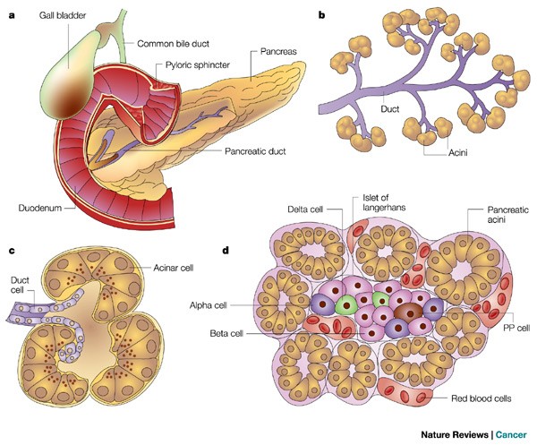 pancreatic cancer